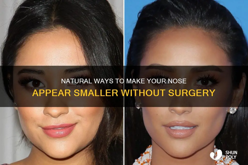 how can i make my nose smaller without plastic surgery