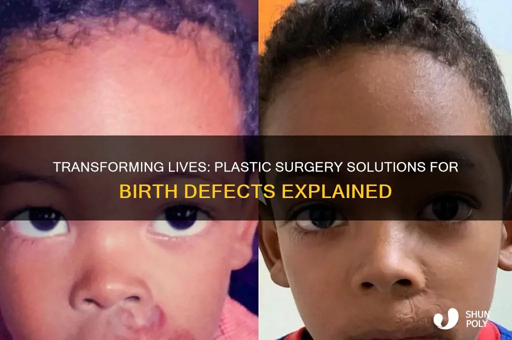 how can plastic surgery help birth defects
