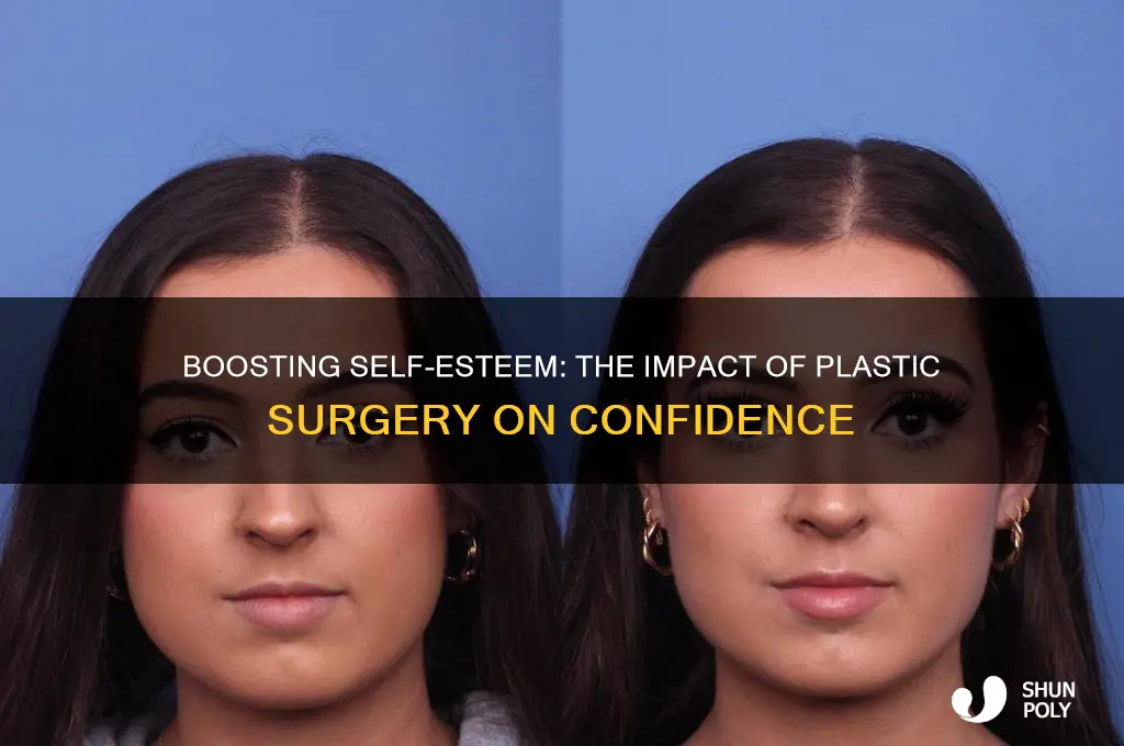 how can self esteem improve through plastic surgery