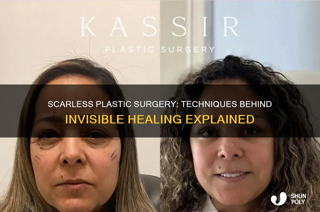 how come plastic surgery doesn