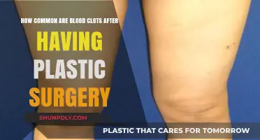 Blood Clots After Plastic Surgery: Risks, Frequency, and Prevention Tips
