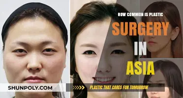 Plastic Surgery Trends in Asia: Popularity, Culture, and Statistics