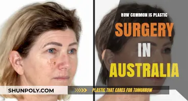 Plastic Surgery Trends: How Common Are Procedures in Australia?