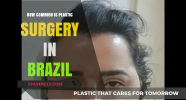Brazil's Plastic Surgery Culture: How Common Are Cosmetic Procedures?