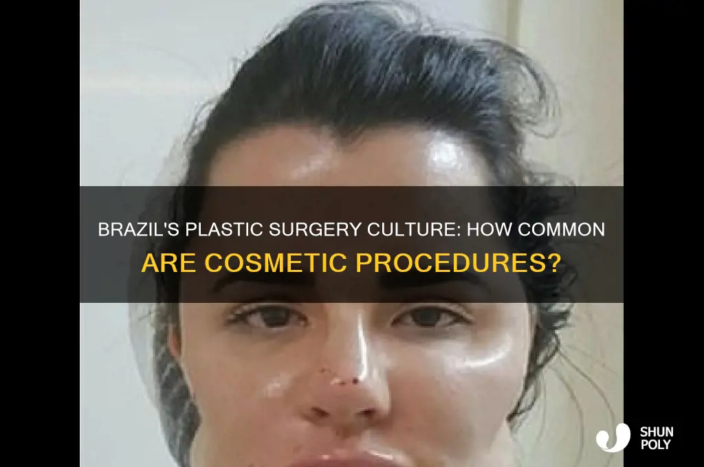 how common is plastic surgery in brazil