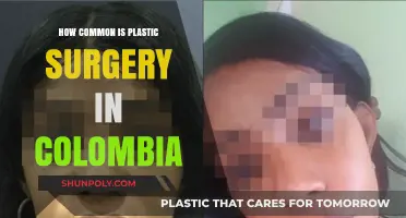 Colombia's Plastic Surgery Trend: How Common Are Cosmetic Procedures?