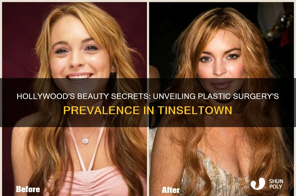 how common is plastic surgery in hollywood