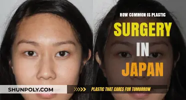 Exploring Japan's Growing Trend: The Popularity of Plastic Surgery