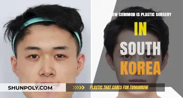 Plastic Surgery in South Korea: Unveiling the Cultural Phenomenon