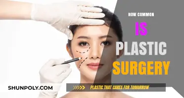 Plastic Surgery Trends: How Common Are Cosmetic Procedures Today?