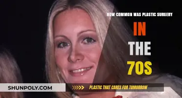 Plastic Surgery in the 70s: Trends, Popularity, and Cultural Impact