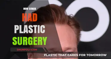 Conan O'Brien's Surprising Plastic Surgery Transformation: The Untold Story
