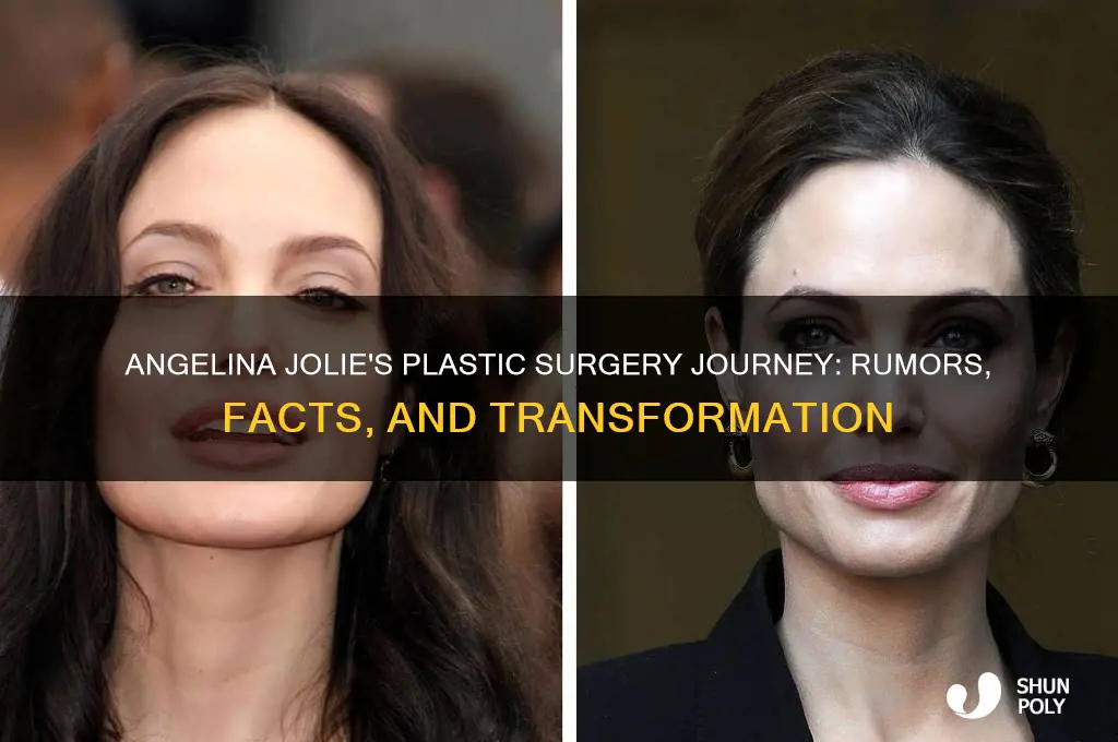 how did angelina jolie do plastic surgery