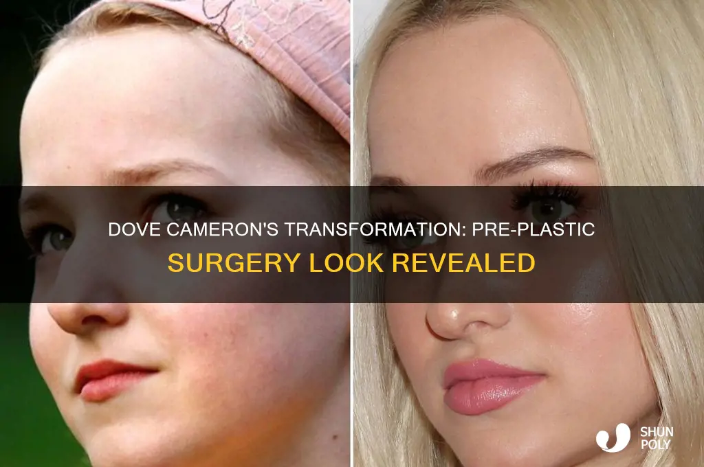 how did dove cameron look before plastic surgery