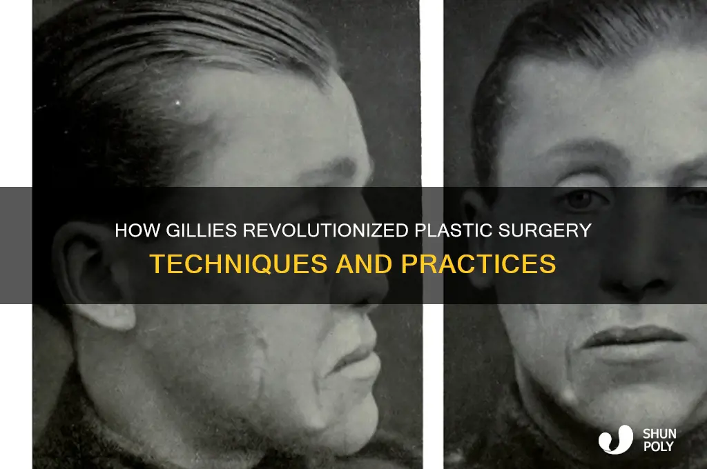 how did gillies change plastic surgery