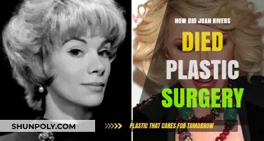 Joan Rivers' Tragic Death: The Plastic Surgery Procedure That Ended Her Life