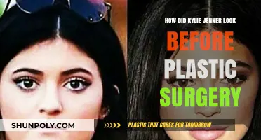 Kylie Jenner's Pre-Surgery Transformation: Unveiling Her Natural Beauty Evolution