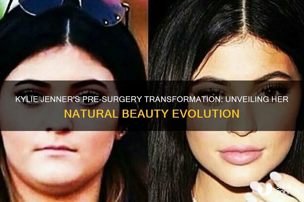 how did kylie jenner look before plastic surgery