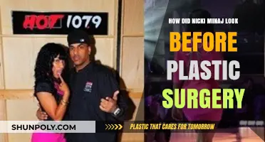 Nicki Minaj's Pre-Surgery Transformation: Unveiling Her Natural Beauty