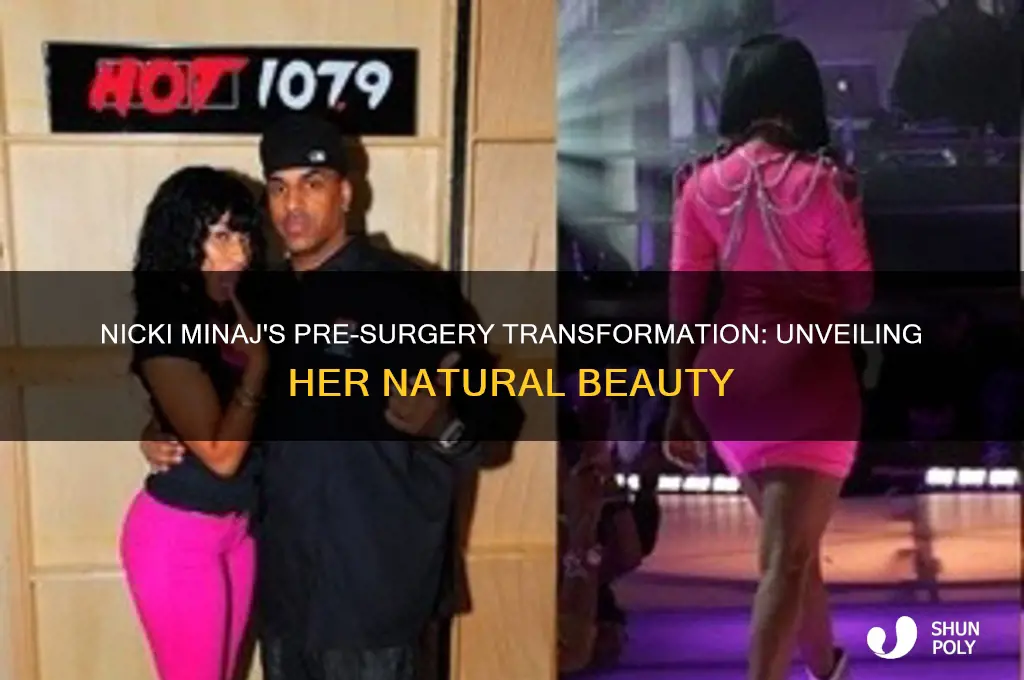 how did nicki minaj look before plastic surgery