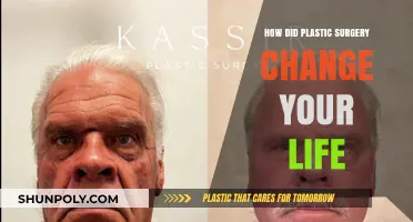 Transforming Lives: My Journey and Impact of Plastic Surgery