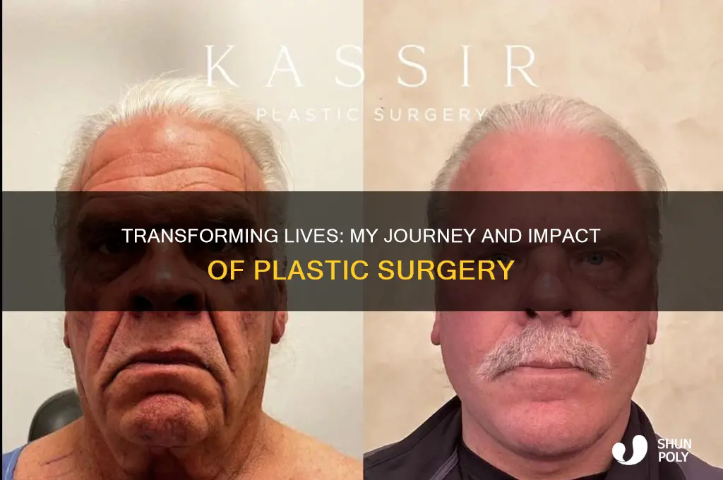 how did plastic surgery change your life