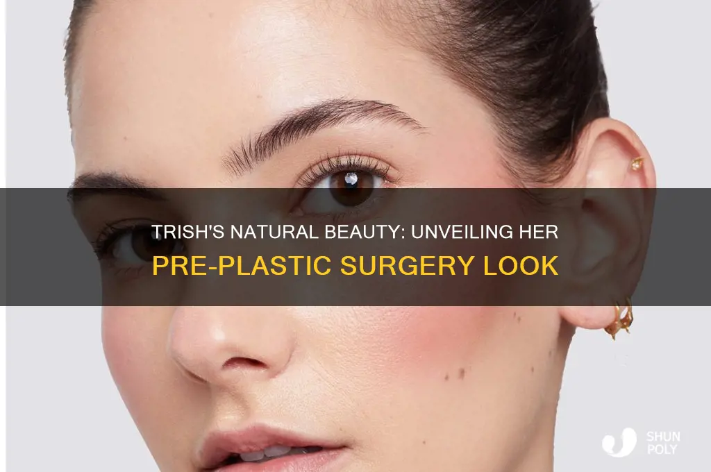 how did trish look without plastic surgery