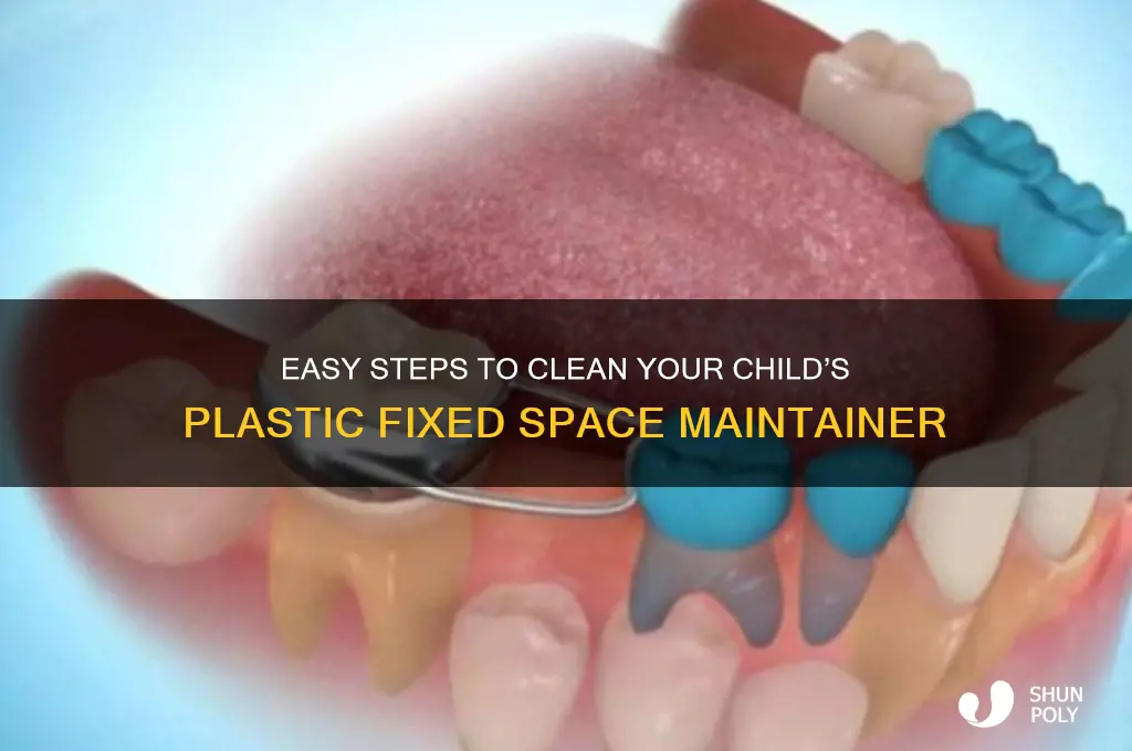 how do i clean a plastic fixed space maintainer