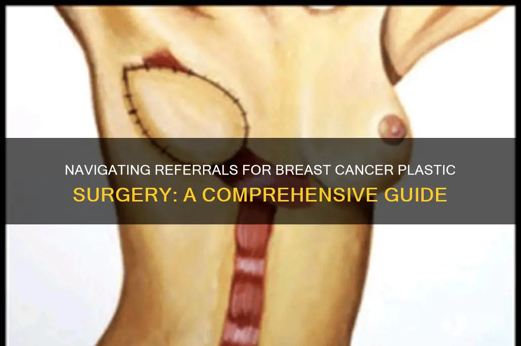 how do i get a referral breast cancer plastic surgery