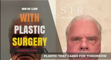 Transformed by the Knife: My Plastic Surgery Journey and Results