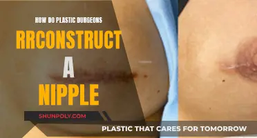 Plastic Surgery: Nipple Reconstruction Techniques