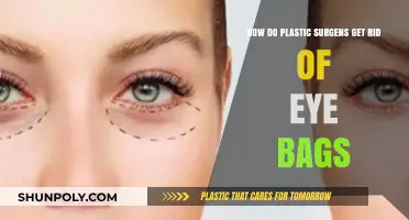 Effective Eye Bag Removal Techniques Used by Plastic Surgeons