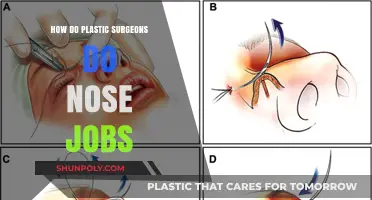 How Plastic Surgeons Perform Rhinoplasty: Techniques and Procedures Explained
