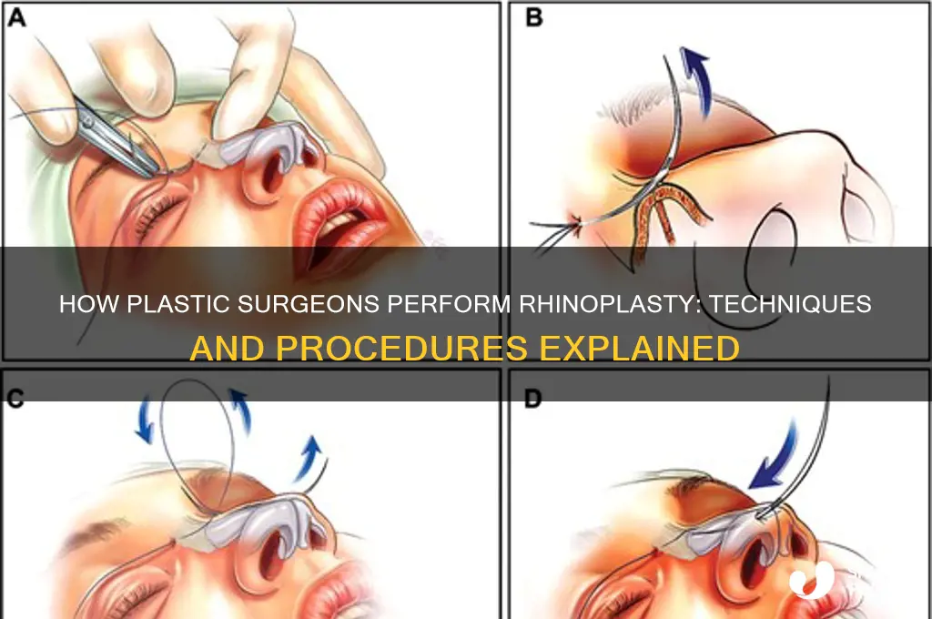 how do plastic surgeons do nose jobs