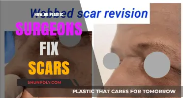 Scar Revision Techniques: How Plastic Surgeons Repair and Restore Skin