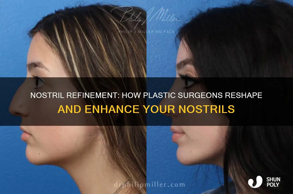 how do plastic surgeons fix your nostrils