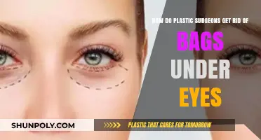 Effective Eye Bag Removal Techniques Used by Plastic Surgeons