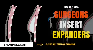 Understanding Tissue Expander Insertion: A Plastic Surgeon's Step-by-Step Guide