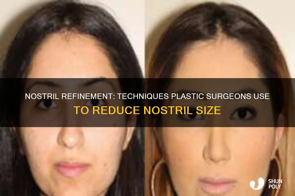 how do plastic surgeons make nostrils smaller