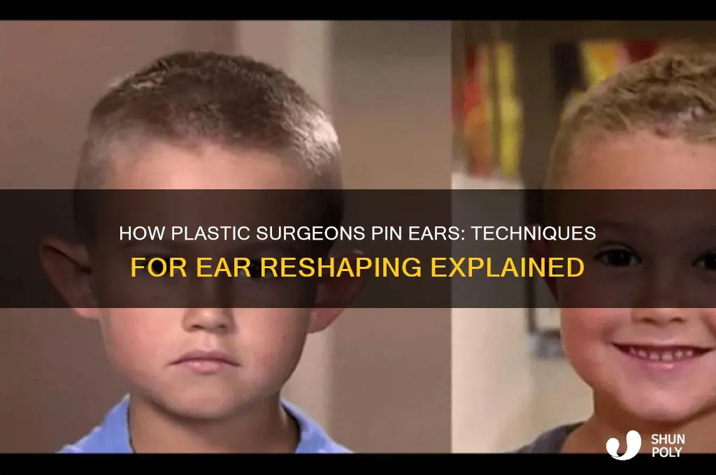 how do plastic surgeons pin ears