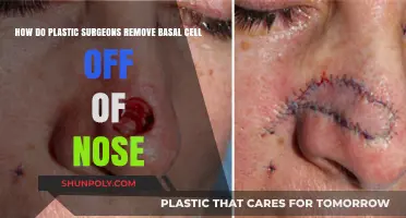 Removing Basal Cell Carcinoma from the Nose: Plastic Surgery Techniques Explained