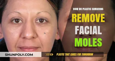 Facial Mole Removal: Techniques Plastic Surgeons Use for Safe Excision