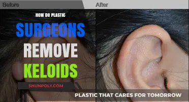 Effective Keloid Removal Techniques Used by Plastic Surgeons Explained