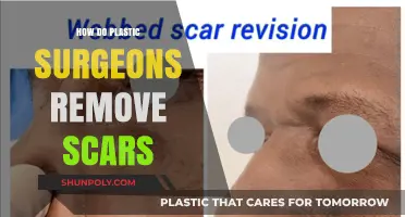 Scar Revision Techniques: How Plastic Surgeons Remove Scars Effectively