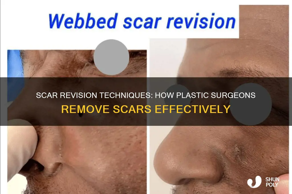 how do plastic surgeons remove scars