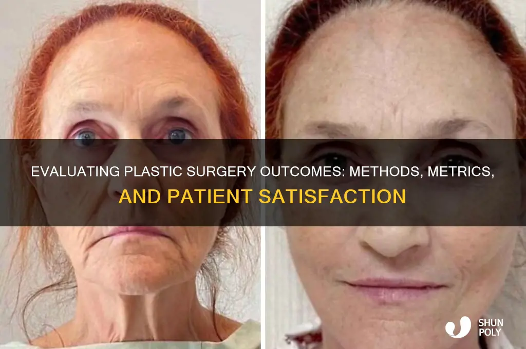 how do plastic surgery evaluate outcomes