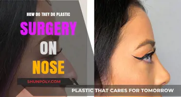Understanding Rhinoplasty: Techniques and Procedures for Nose Reshaping Surgery