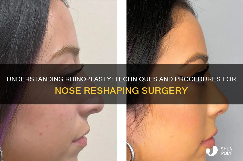 how do they do plastic surgery on nose