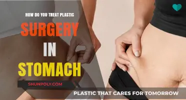 Effective Treatment Options for Stomach Plastic Surgery Recovery and Care