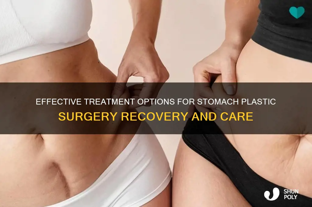 how do you treat plastic surgery in stomach